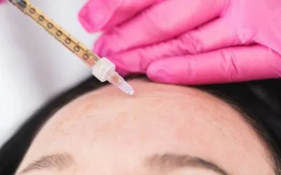 NCTF Mesotherapy Treatment