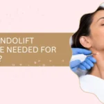 How Many Endolift Sessions Are Needed for Neck Laxity